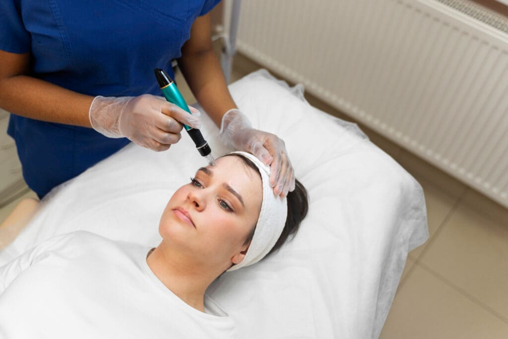 Microneedling with PRP treatment being performed in a medical spa setting
